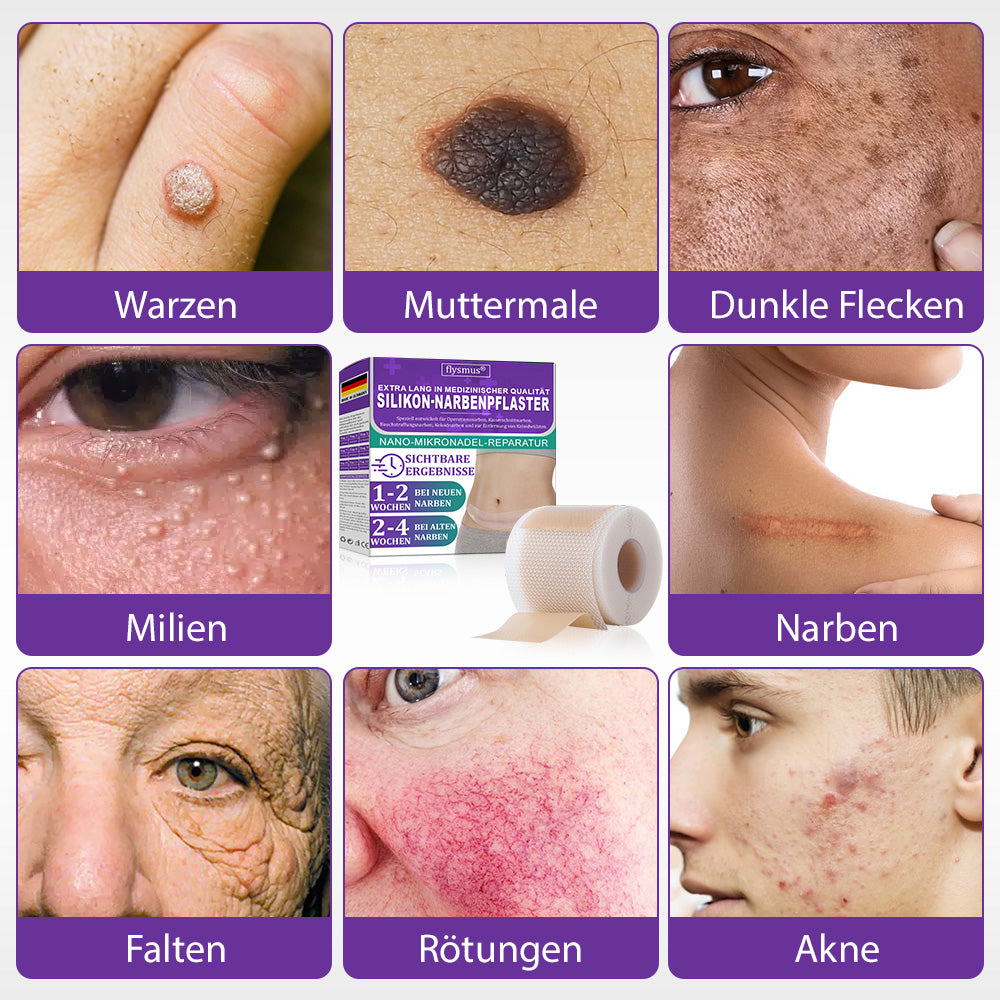 🌼Offizieller Shop🏷️: Flysmus® ReGen Hyaluronsäure Nano-Heal Mikronadel-Pflaster – 💝Behandlung von alten und neuen Narben, Reduktion von Operationsnarben, Dehnungsstreifen, Keloiden, Akne, Verbrennungen, Warzen, Hautveränderungen und Krampfadern