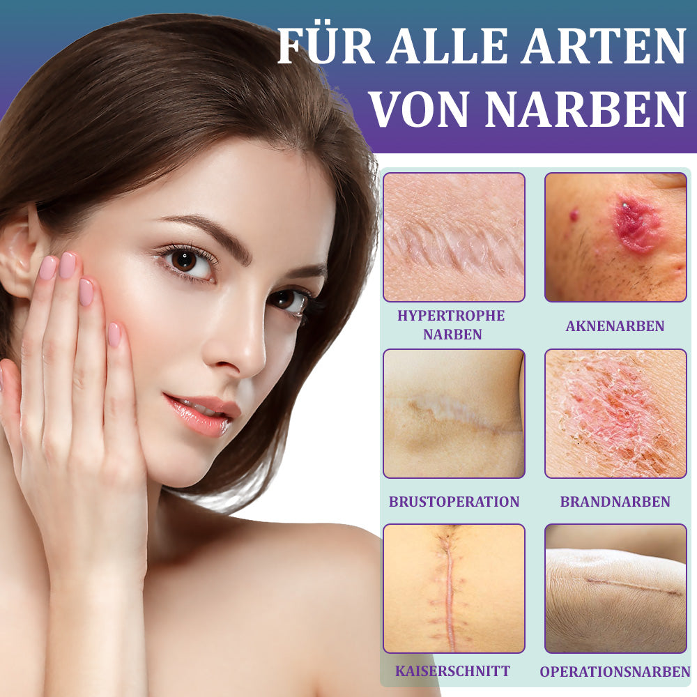 🌼Offizieller Shop🏷️: Flysmus® ReGen Hyaluronsäure Nano-Heal Mikronadel-Pflaster – 💝Behandlung von alten und neuen Narben, Reduktion von Operationsnarben, Dehnungsstreifen, Keloiden, Akne, Verbrennungen, Warzen, Hautveränderungen und Krampfadern