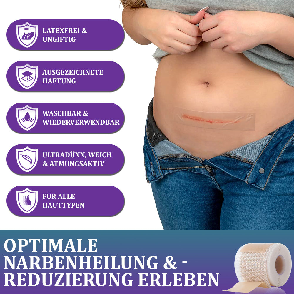 🌼Offizieller Shop🏷️: Flysmus® ReGen Hyaluronsäure Nano-Heal Mikronadel-Pflaster – 💝Behandlung von alten und neuen Narben, Reduktion von Operationsnarben, Dehnungsstreifen, Keloiden, Akne, Verbrennungen, Warzen, Hautveränderungen und Krampfadern