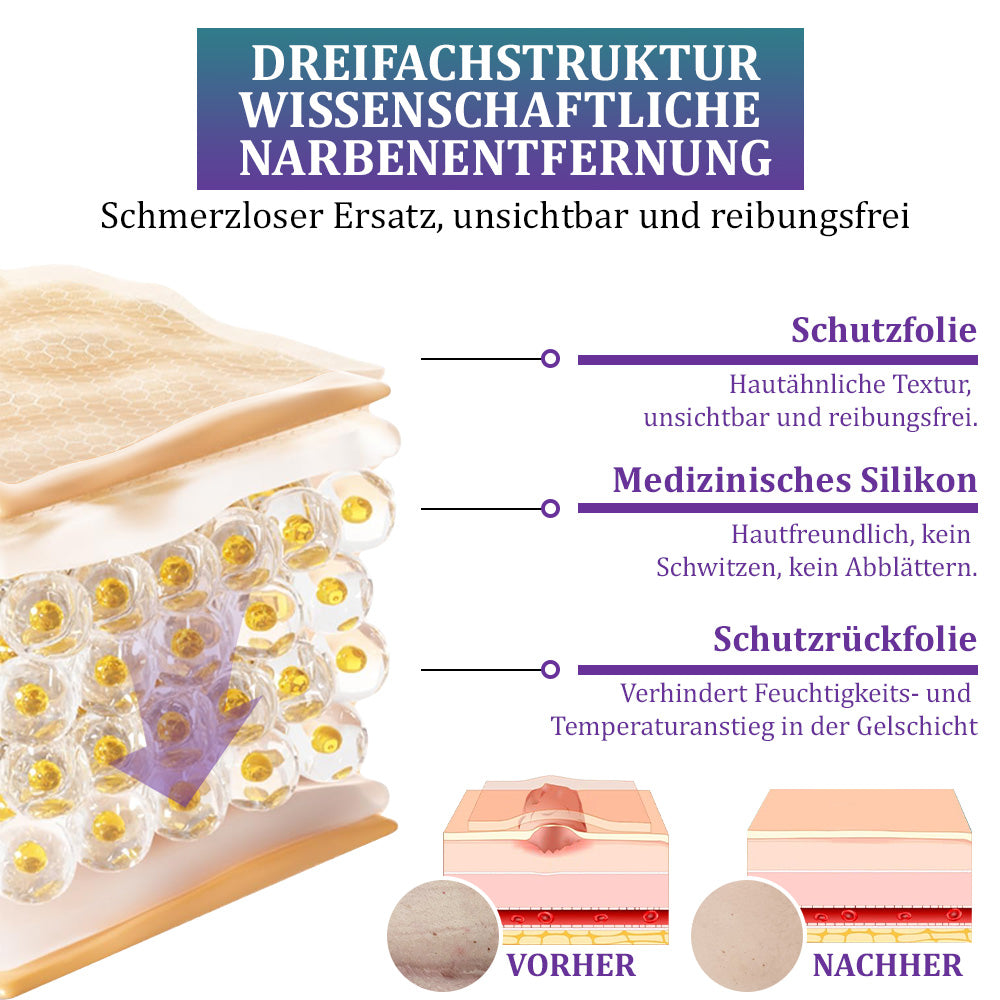 🌼Offizieller Shop🏷️: Flysmus® ReGen Hyaluronsäure Nano-Heal Mikronadel-Pflaster – 💝Behandlung von alten und neuen Narben, Reduktion von Operationsnarben, Dehnungsstreifen, Keloiden, Akne, Verbrennungen, Warzen, Hautveränderungen und Krampfadern