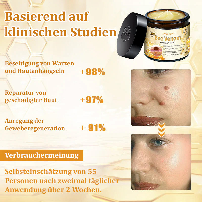 ✅Offizieller Store: 🌿Turonu™ Bienengift Multitherapie-Creme(🧑‍⚕️Dermatest-Zertifizierung)