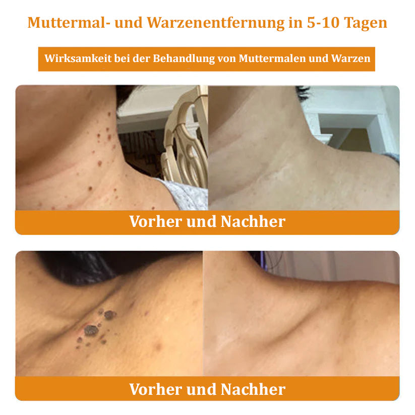 ✅Offizieller Store: 🌿Turonu™ Bienengift Multitherapie-Creme(🧑‍⚕️Dermatest-Zertifizierung)