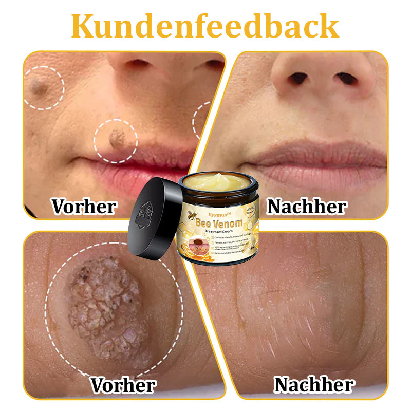 ✅Offizieller Store: 🌿Turonu™ Bienengift Multitherapie-Creme(🧑‍⚕️Dermatest-Zertifizierung)