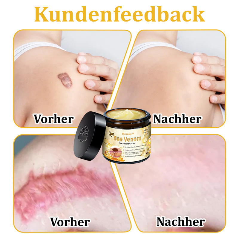 ✅Offizieller Store: 🌿Turonu™ Bienengift Multitherapie-Creme(🧑‍⚕️Dermatest-Zertifizierung)